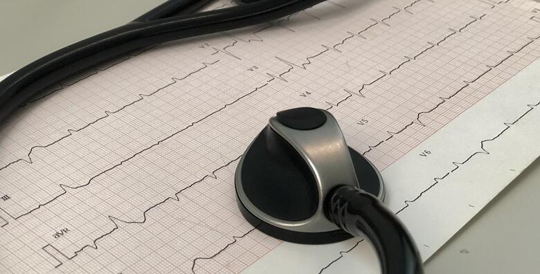 EKG srca -50%