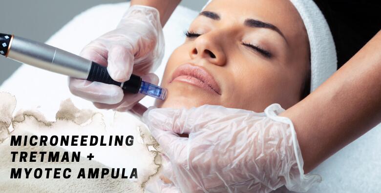 Microneedling -45% Centar
