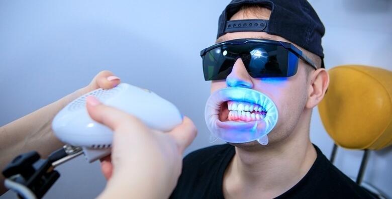 Izbjeljivanje zubi Opalescence Boost gelom i LED lampom uz odmah vidljive rezultate za 199 kn!