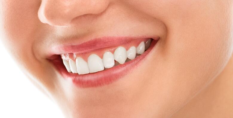 Cirkon keramička krunica s kompozitnom nadogradnjom u Dental centru inDent za 1.750 kn!