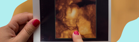 4D ultrazvuk i DVD snimka vaše bebe na drugačiji način pomoću kvalitetnog Samsung uređaja u centru grada