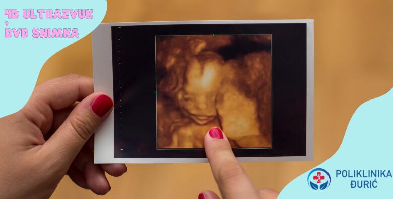 POPUST: 43% - 4D ultrazvuk i DVD snimka vaše bebe na drugačiji način uz uključen anomaly scan pomoću kvalitetnog Samsung uređaja u centru grada (Poliklinika Đurić)