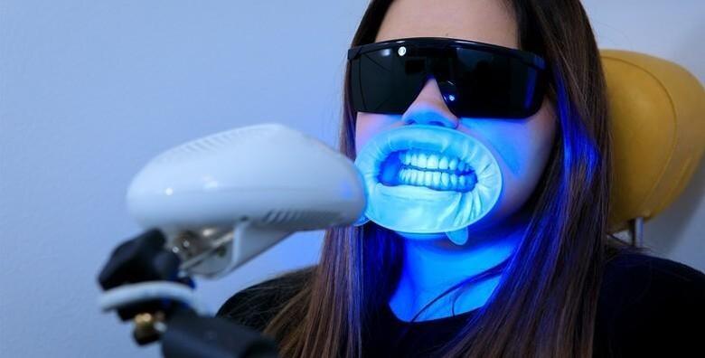Izbjeljivanje zubi Opalescence Boost gelom i LED lampom uz ODMAH vidljive rezultate za 299 kn!