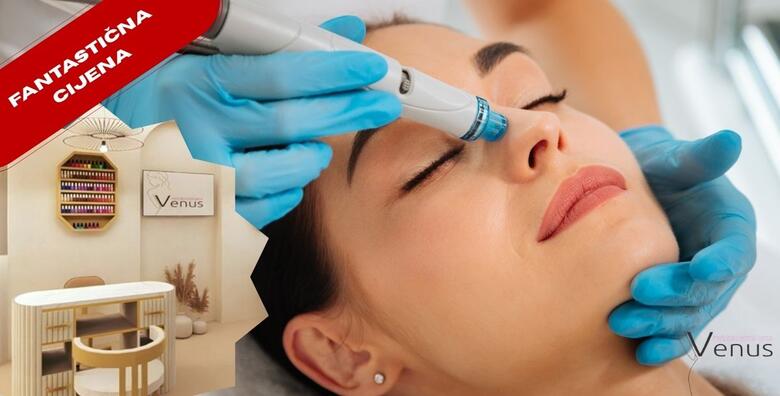 JEDINSTVENA “ONE-TIME” PONUDA – osvježite kožu svoga lica HYDRAFACIAL tretmanom u NOVOOTVORENOM Medicinsko estetskom centru Venus by Lucija Šarić u SESVETAMA