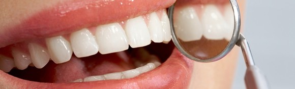 IZBJELJIVANJE ZUBI Opalescence boost tehnologijom - savršen osmjeh uz do 3 nijanse svjetlije zube i trajnost do čak 3 godine