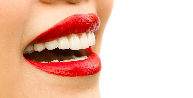 POPUST: 50% - Jednoplošni, dvoplošni ili troplošni ispun (plomba) uz pregled u Dental Studiju Marić - osigurajte si zdrave i blistave zube za 199 kn! (Dental studio Marić)