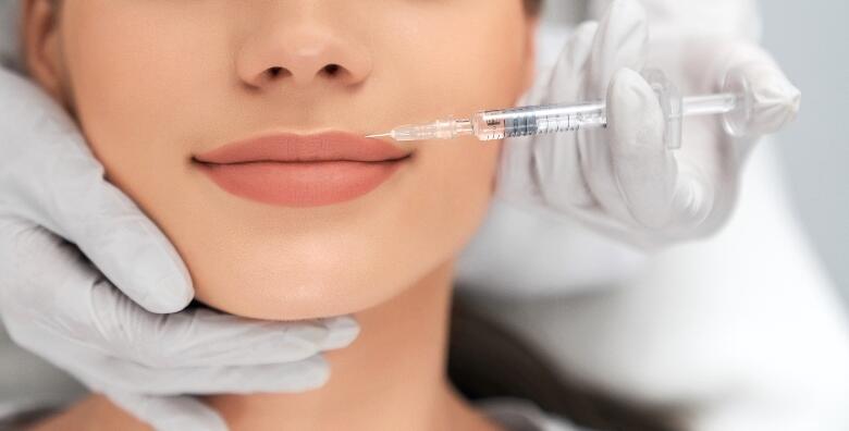 1 ML FILERA ZA USNICE - ljepše i punije usne uz popularni MyFiller GLIPS koji rezultira fantastičnim sjajem u Dental Studiju Marić za 1.599 kn!