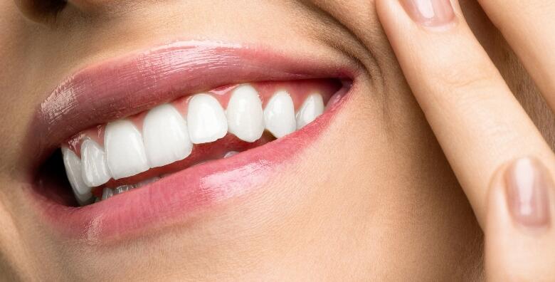 POPUST: 45% - Ispravite oblik, boju, veličinu ili položaj zuba uz uveneer kompozitne ljuskice + pregled te bez skrivanja pokažite svoj novi osmijeh za 549 kn! (Dental studio Marić)