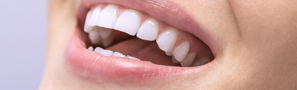 Čišćenje zubnog kamenca sa pjeskarenjem uz pregled u Dental studiju Marić