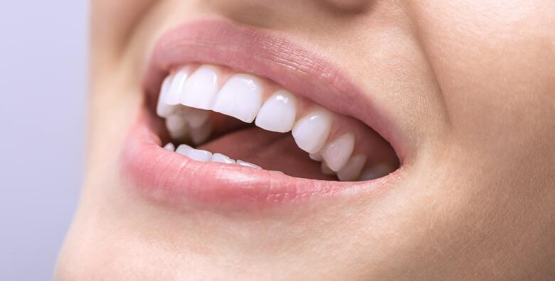 MEGA POPUST: 70% - Čišćenje zubnog kamenca sa pjeskarenjem uz pregled u Dental studiju Marić (Dental studio Marić)