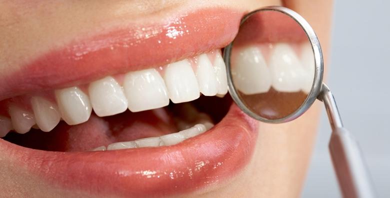 Izbjeljivanje zubi -66% Trešnjevka