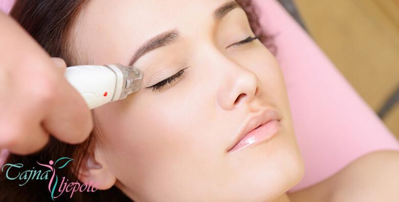 Pozdravite se s aknama i borama – mikrodermoabrazija uz kisik tretman lica, njegu hijaluronskim serumom i maskom od kavijara u salonu Tajna ljepote