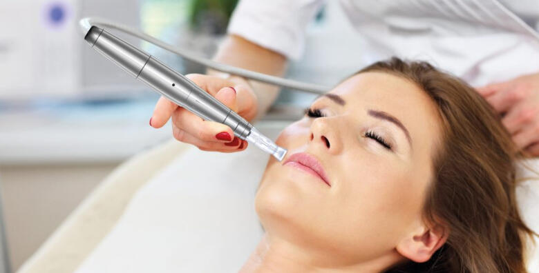 POPUST: 62% - Microneedling - uklonite bore i ožiljke uz nekiruršku metodu pomlađivanja lica, ultrazvučno čišćenje, ultrazvuk i masku za 499 kn! (Jean d`Arcel Medical & Beauty Institut)