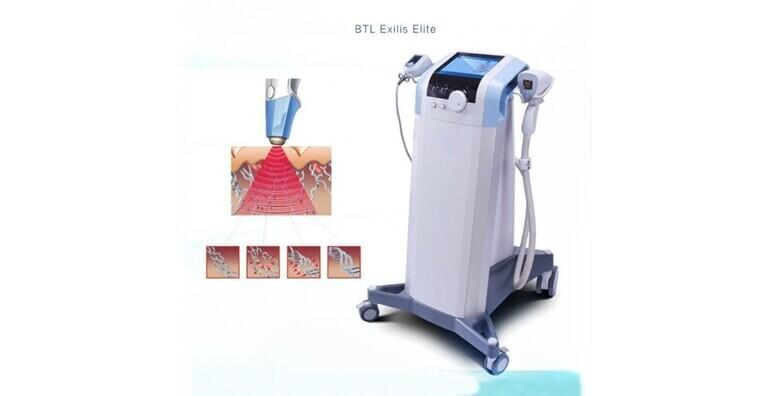 Exilis tretman cijelog lica -33%