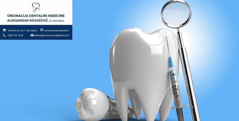 Zubni implantat, Rijeka