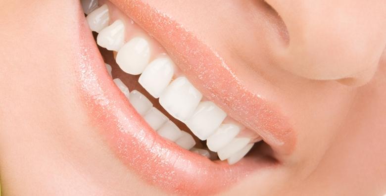 MEGA POPUST: 80% - Čišćenje zubnog kamenca i poliranje zubi uz pregled - podarite zubima sjaj i njegu kakvu ste oduvijek željeli za 99 kn! (Ordinacija dentalne medicine Jelena Henc)