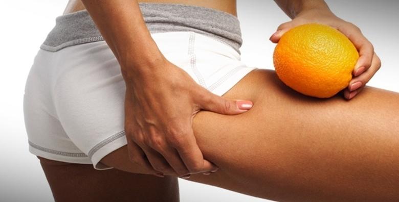 KAVITACIJA – riješite se masnih naslaga uz 3 tretmana kavitacije u La Camilla Beauty & Nutrition Centru za 299 kn!