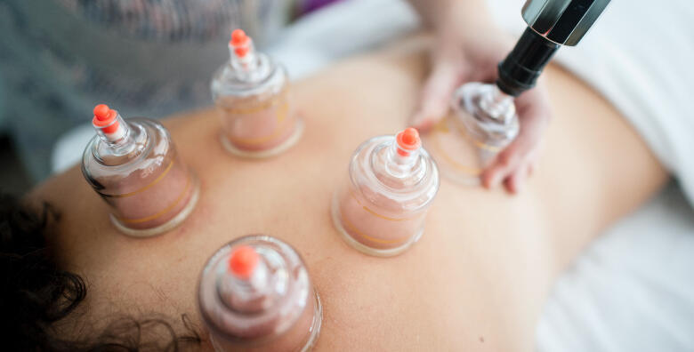 Masaža leđa s cupping terapijom u trajanju 30 minuta za samo 99 kn!