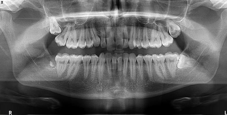 POPUST: 58% - Digitalni ortopan s pregledom - kvalitetna i čista snimka cijele čeljusti  u Dental studiju La dental u Bjelovaru za 129 kn! (The dental studio La dental)