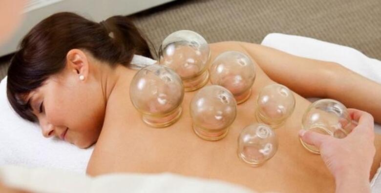 Riješite se bolova uz cupping masažu od 30 ili 60 minuta uz pregled fizioterapeuta od 100 kn!