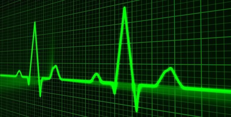 Specijalistički kardiološki pregled s kompletnom obradom za 1.090 kn!