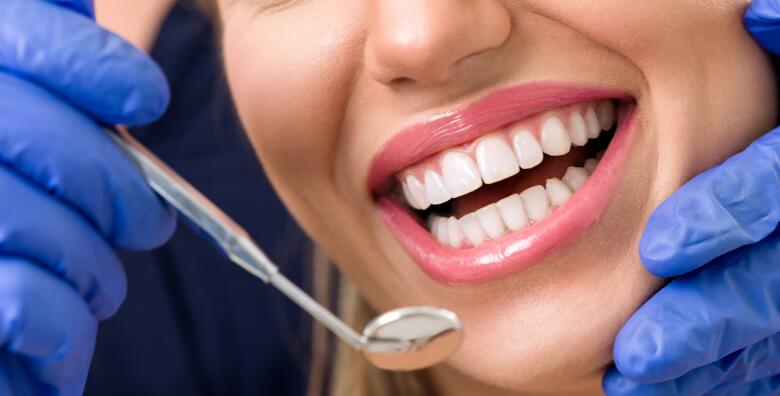POPUST: 67% - Profesionalno čišćenje zubnog kamenca, pjeskarenje i poliranje uz vrhunski tim stručnih stomatologa Poliklinike Life (Ustanova za zdravstvenu skrb Vaš pregled)