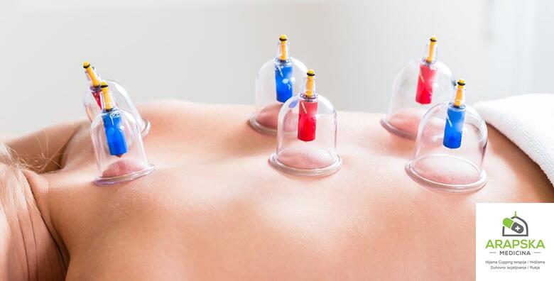 Cupping terapija (hidžama) – poboljšajte opće psihofizičko stanje organizma,  riješite se štetnih tvari i omogućite tijelu ozdravljenje za 280 kn!