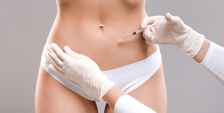INJEKCIJSKA LIPOLIZA – uklonite potkožno masno tkivo neinvazivnim oblikom terapije u Poliklinici Superiora