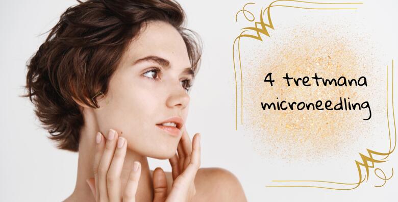 POPUST: 50% - Potaknite obnovu kože i proizvodnju kolagena uz paket od 4 tretmana MICRONEEDLINGA u salonu aOra Beauty Awareness (aOra Beauty Awareness)