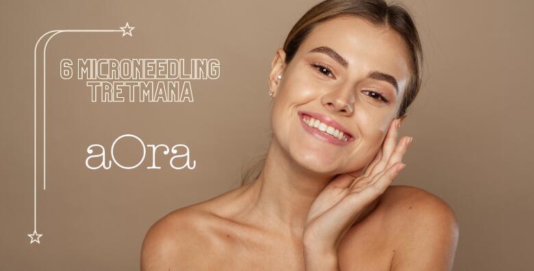 Microneedling - 6 tretmana -60%