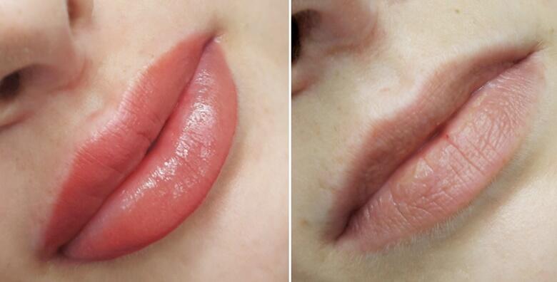 LIP BLUSH – hit tretman za usne kojim se naglašava prirodna boja, poboljšava oblik i postiže puniji efekt uz trajanje i do 3 godine
