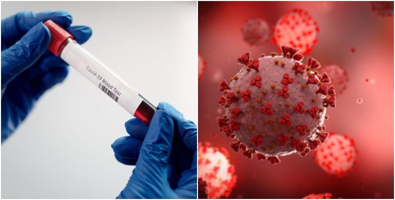 SPLIT, vađenje antitijela iz krvi za COVID-19 - otkrijte jeste li bili izloženi virusu u Poliklinici Falcon Peregrin za 129 kn!