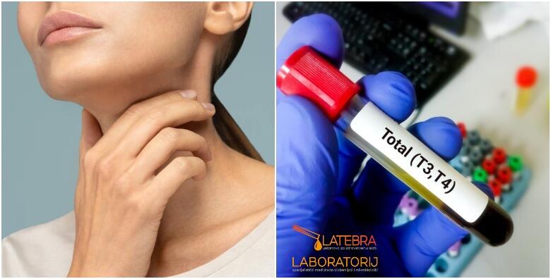 Veliki paket štitnjače – pravovremeno prepoznajte nepravilan rad štitnjače uz laboratorijske pretrage u Laboratoriju Latebra