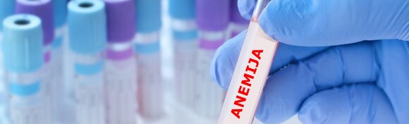 Saznajte jeste li ANEMIČNI uz komplet laboratorijskih pretraga koje otkrivaju nedostatak željeza, čak i ako trenutno nemate simptome! Nalazi gotovi isti dan