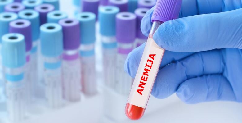 Saznajte jeste li ANEMIČNI uz komplet laboratorijskih pretraga koje otkrivaju nedostatak željeza, čak i ako trenutno nemate simptome! Nalazi gotovi isti dan