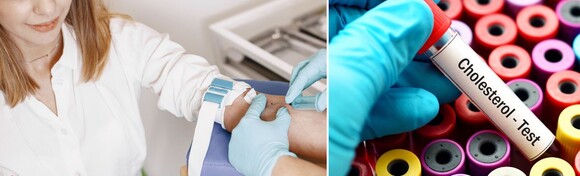 Brinite o zdravlju svog srca uz panel za KOLESTEROL - jednostavan test koji otkriva razinu masnoća u krvi i pomaže u procjeni rizika za bolesti srca i krvnih žila u Laboratoriju Latebra