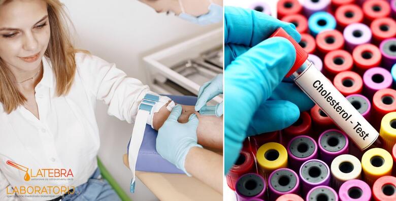 Brinite o zdravlju svog srca uz panel za KOLESTEROL – jednostavan test koji otkriva razinu masnoća u krvi i pomaže u procjeni rizika za bolesti srca i krvnih žila u Laboratoriju Latebra