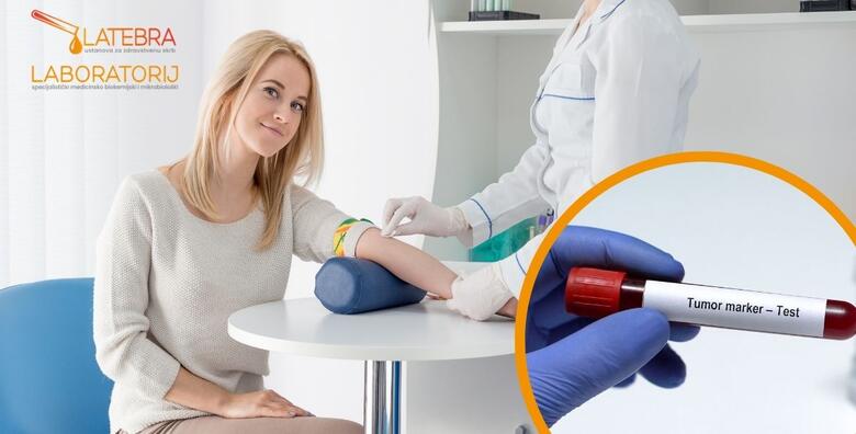Tumorski markeri za žene – otkrijte problem na vrijeme uz specifične testove koji pomažu u prepoznavanju rizika za nekoliko vrsta raka, uključujući rak jajnika, dojke i debelog crijeva