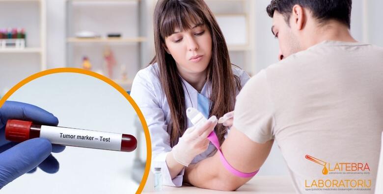 Tumorski markeri za muškarce - specifični testovi koji pomažu u procjeni rizika za rak prostate, debelog crijeva i drugih gastrointestinalnih problema u Laboratoriju Latebra