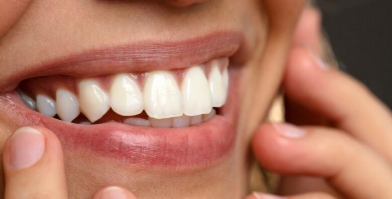 POPUST: 43% - Spriječite širenje karijesa uz jednoplošni, dvoplošni ili troplošni ispun + kontrolni pregled GRATIS u Ordinaciji dentalne medicine Maja Parlov (Ordinacija dentalne medicine Maja Parlov)