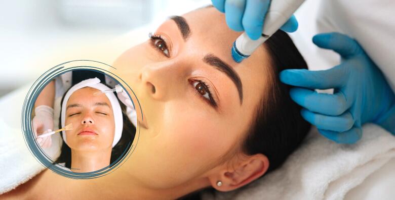 Radiofrekvencija i vacum air lifting lica – prirodni tretman koji uz pomoć zraka stimulira kolagen te izvlači otečenost lica u ANTIA salonu za njegu i oblikovanje tijela