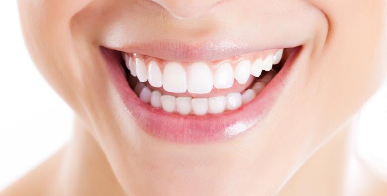 Izbjeljivanje zubi white smile gelom uz čišćenje zubnog kamenca, poliranje, pregled i plan terapije u Ordinaciji Dent Natura