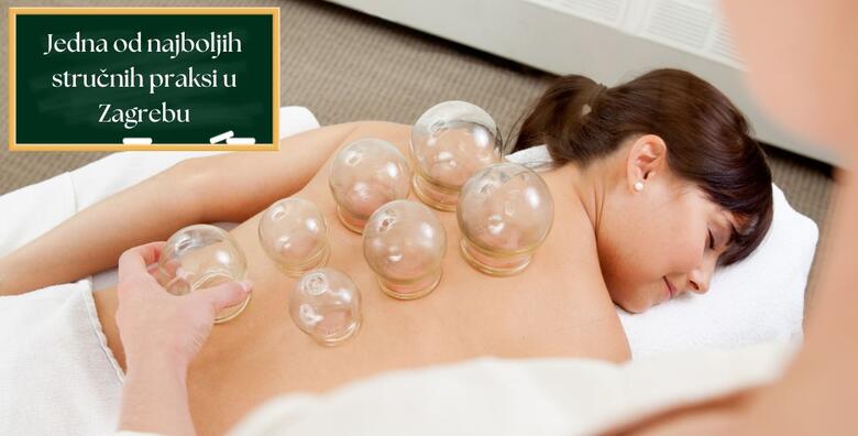 Edukacija cupping masaže – usvojite tehniku za ciljanu i preciznu primjenu cupping masaže u Ustanovi Dominus