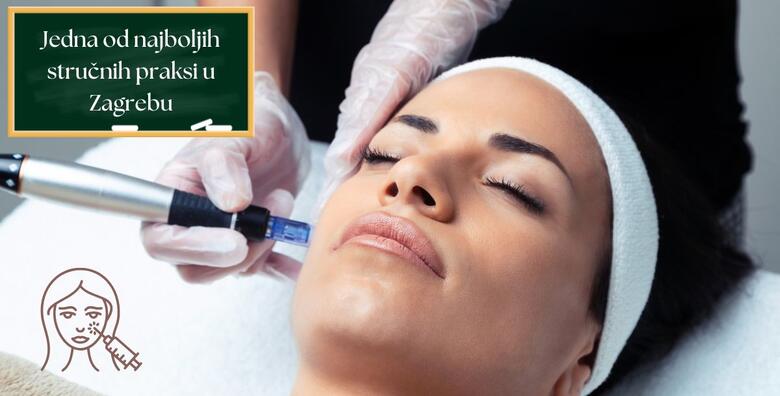 Tečaj Dermapen microneedlinga – naučite izvoditi popularan tretman estetske dermatologije i kako riješiti različite kožne probleme u organizaciji Ustanove Dominus