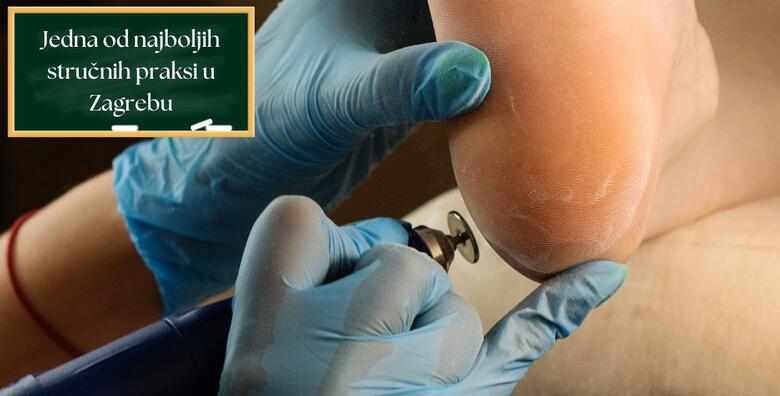 Tečaj medicinske pedikure – naučite pravilnu obradu nokta te otklanjanje boli i problema uz GRATIS medicinsku parcijalnu masažu za svakog upisanog polaznika u Ustanovi Dominus