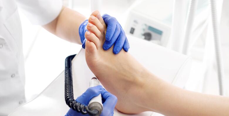 POPUST: 36% - Medicinska pedikura - riješite problem zadebljane kože, natisaka ili ostalih kožnih problema na nogama u Frizersko-kozmetičkom salonu Saba (Frizersko-kozmetički salon Saba)