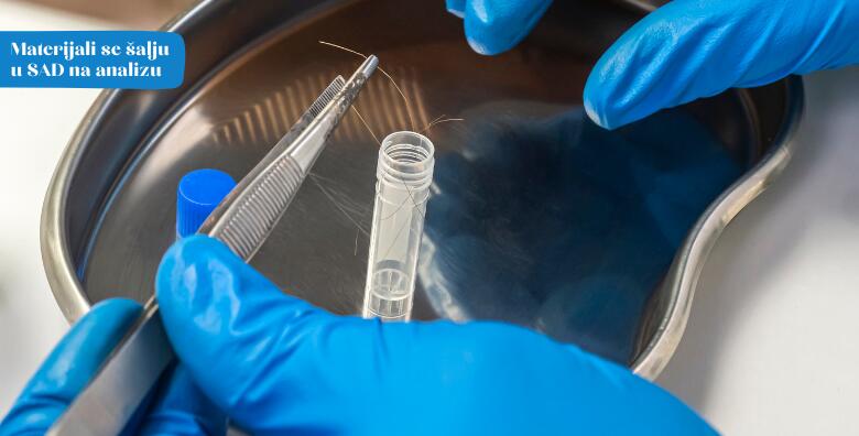 Analiza kose na teške metale – ukoliko ne možete otkriti uzrok bolesti obavite pretragu koja će pomoći u rješavanju vaših tegoba