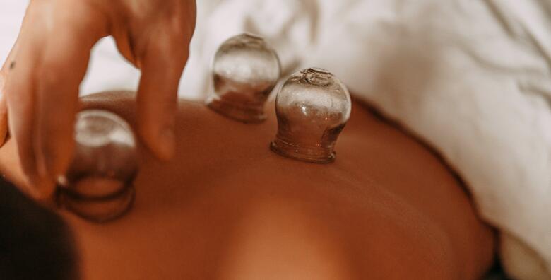Ponuda dana: Ublažite simptome upala uz medicinsku masažu leđa s cupping terapijom u trajanju 50 minuta u La Camilla Beauty baru (La Camilla Beauty bar)