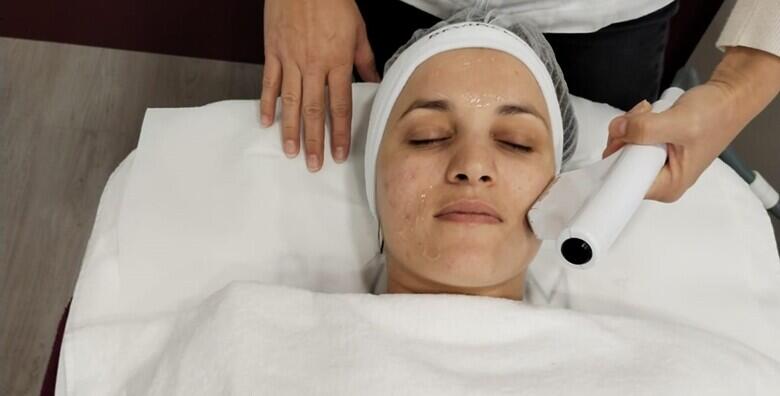 Microneedling tretman najsuvremenijim uređajem za elastičniju i zaglađeniju kožu  lica uz uključen ultrazvuk u Re-age centru i kozmetičarku s 15-godišnjim iskustvom