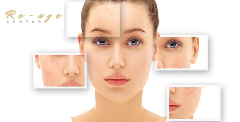 POPUST: 51% - Njega lica i hidratizacija za sve tipove kože uz UZV lica, ampule i hidratantnu masku za lice + GRATIS korekcija obrva u Re-age centru uz stručne ruke dugogodišnje kozmetičarke (Re-age Centar)